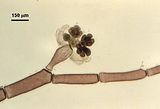 3 – Dettaglio del carposporofito con filamenti involucrali